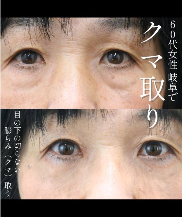 60代女性の症例